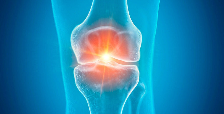 Inflammation dans le genou